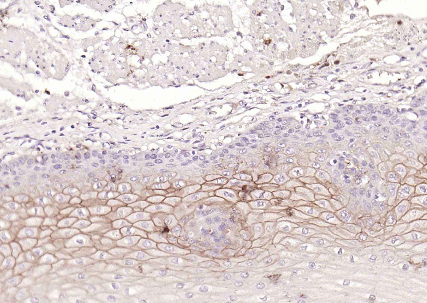 多配体蛋白聚糖1（CD138）重组兔单抗-bsm-60902R
