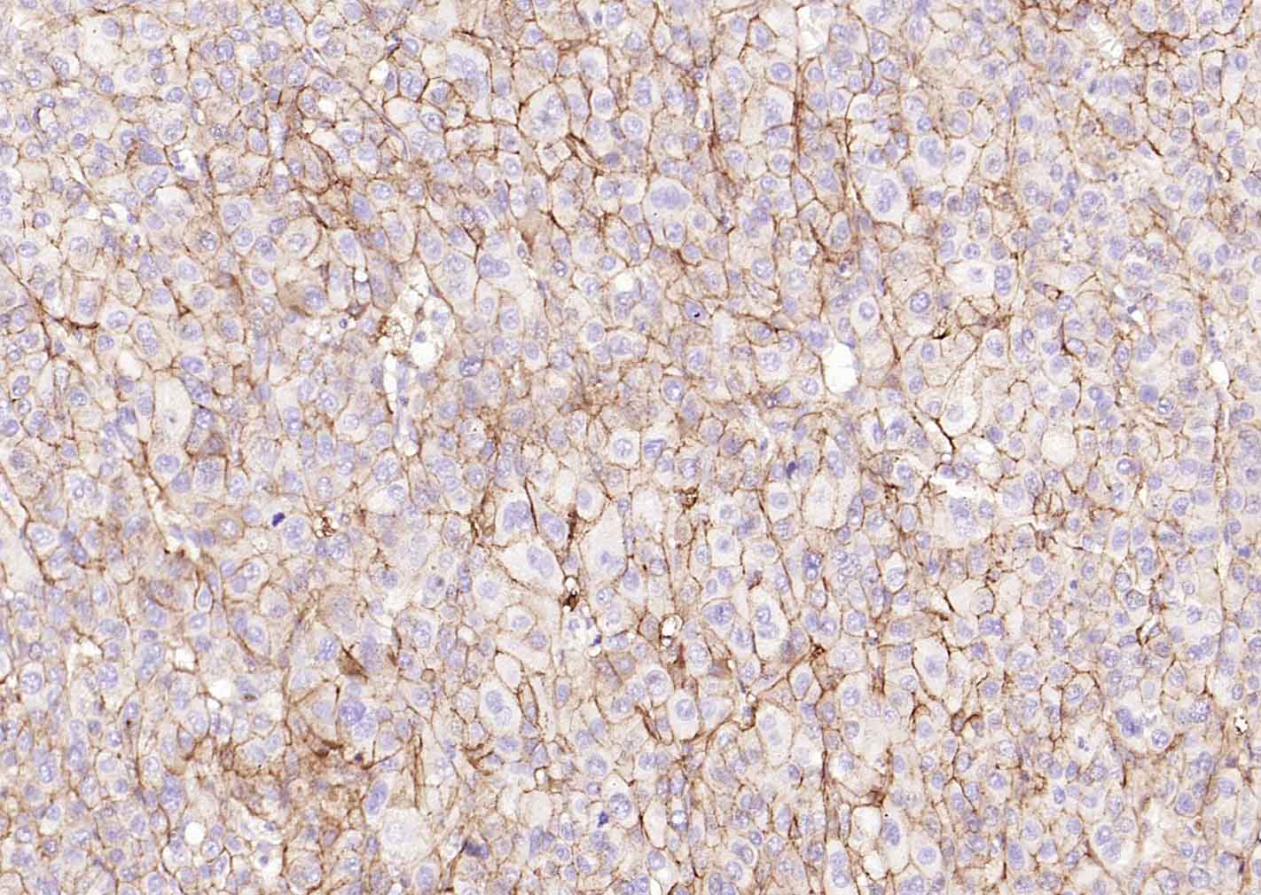 多配体蛋白聚糖1（CD138）重组兔单抗-bsm-60902R