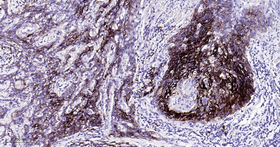 多配体蛋白聚糖1（CD138）重组兔单抗-bsm-60902R