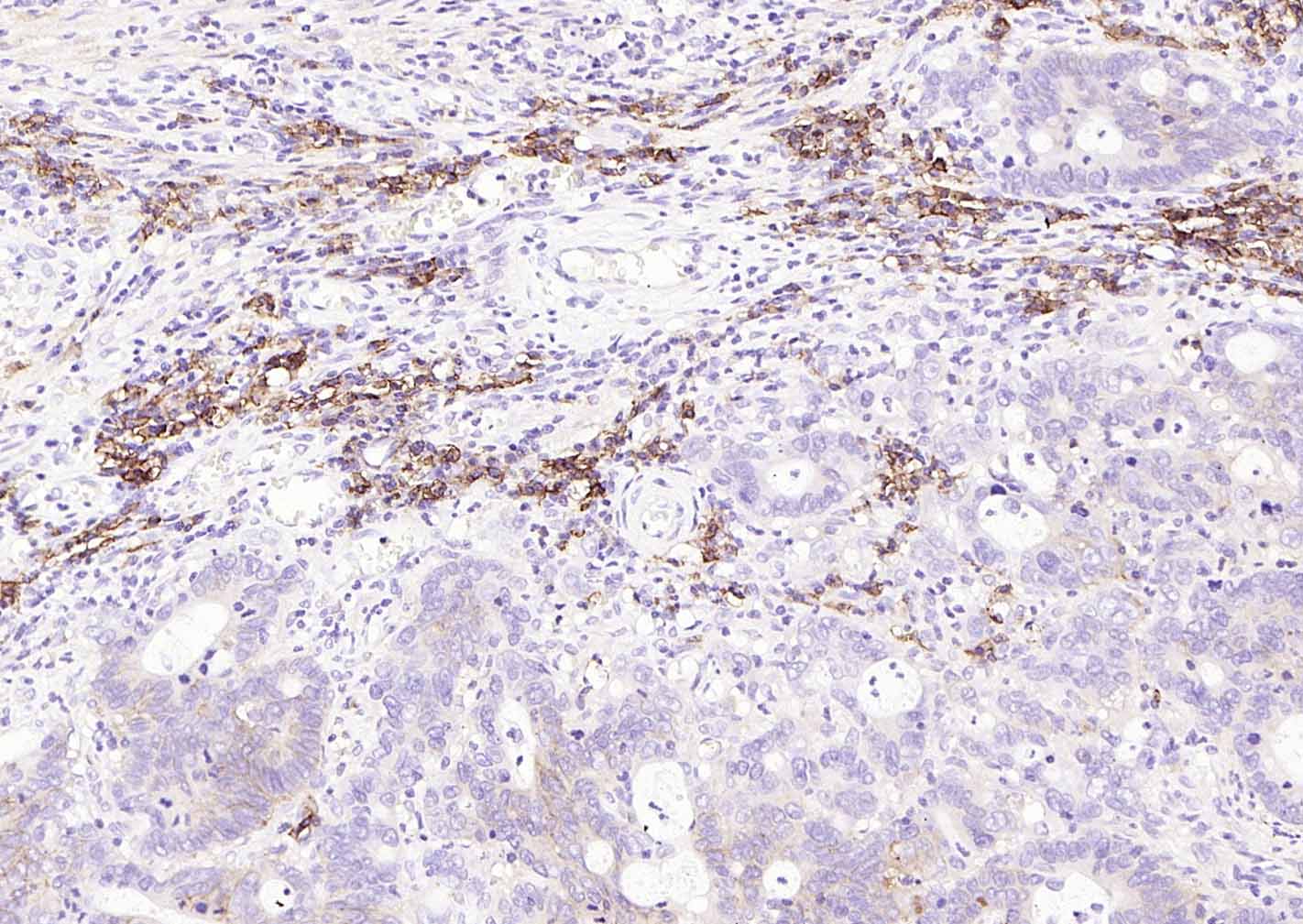 多配体蛋白聚糖1（CD138）重组兔单抗-bsm-60902R