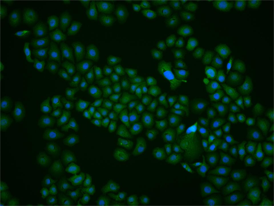 缺氧诱导因子1β/HIF-1β抗体-bs-1407R