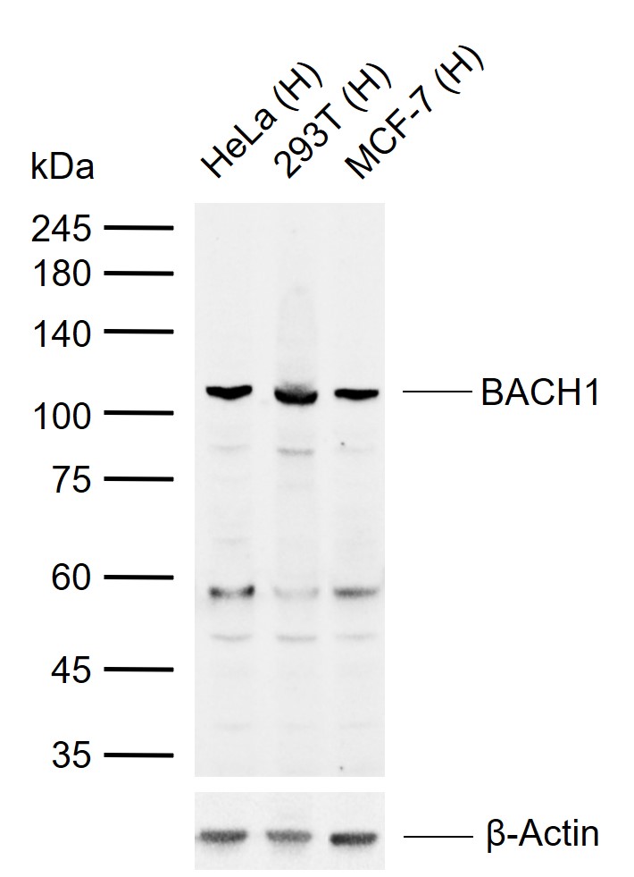 转录调节蛋白BACH1.3抗体-bs-8768R