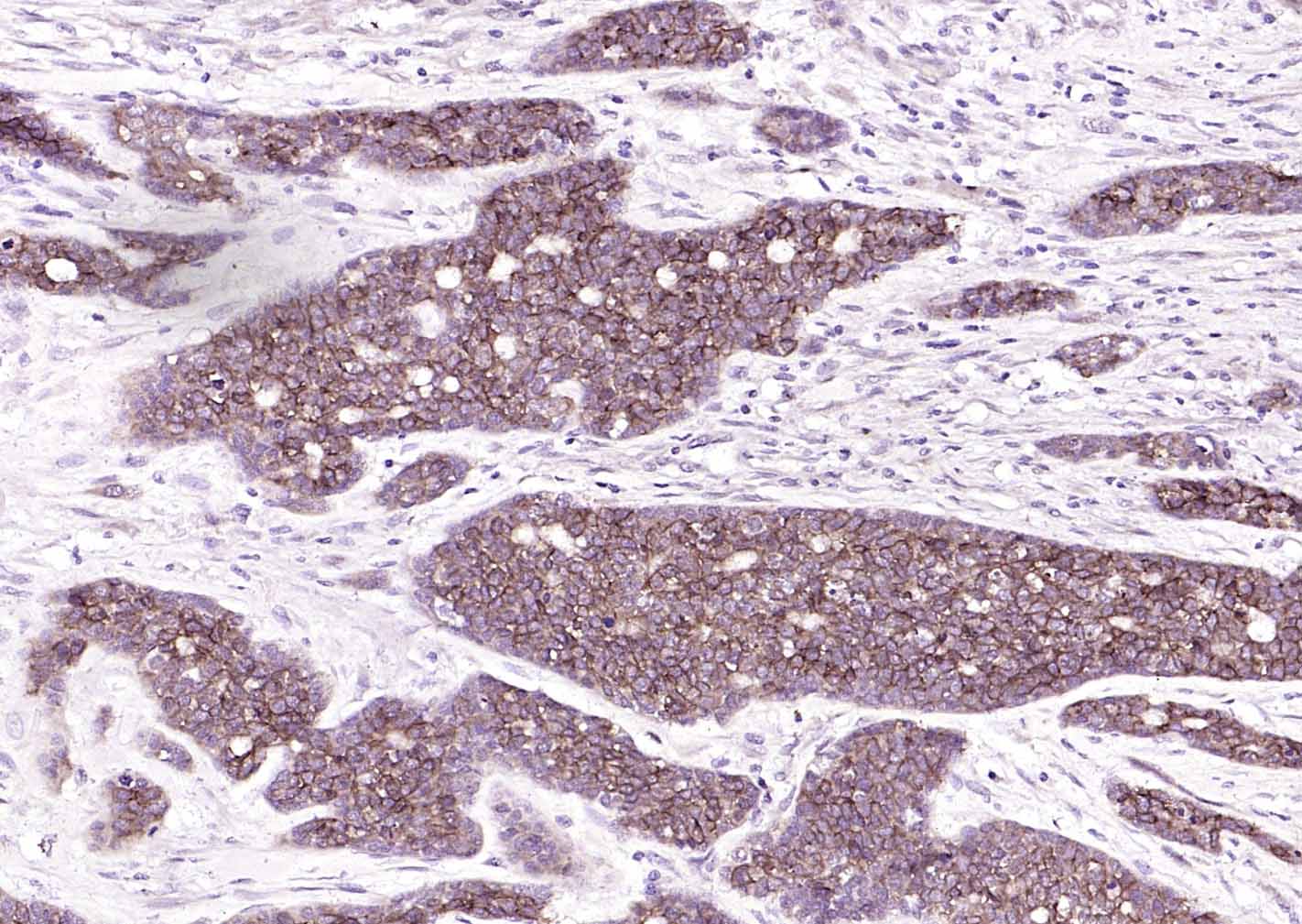 上皮细胞粘附分子（CD326）重组兔单抗-bsm-52417R