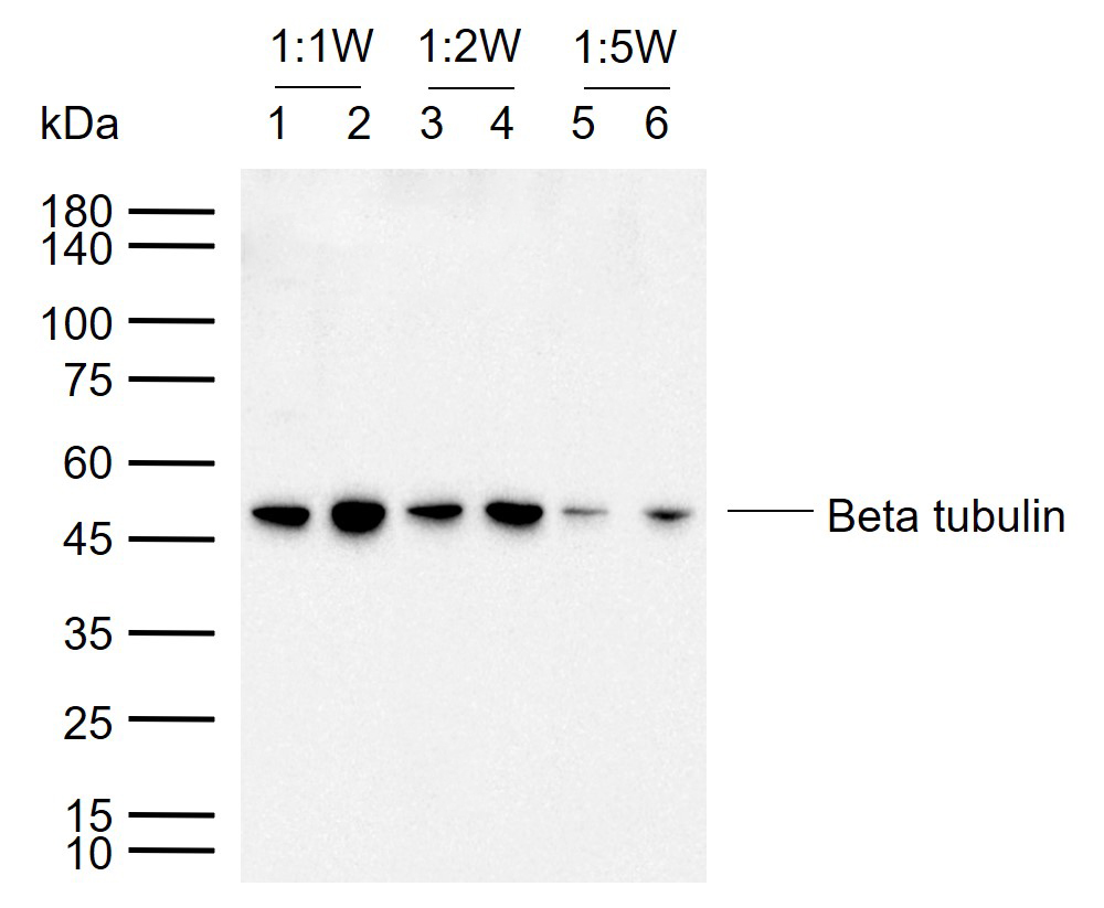 微管蛋白β tubulin/Tubulin β（内参）抗体-bs-4511R