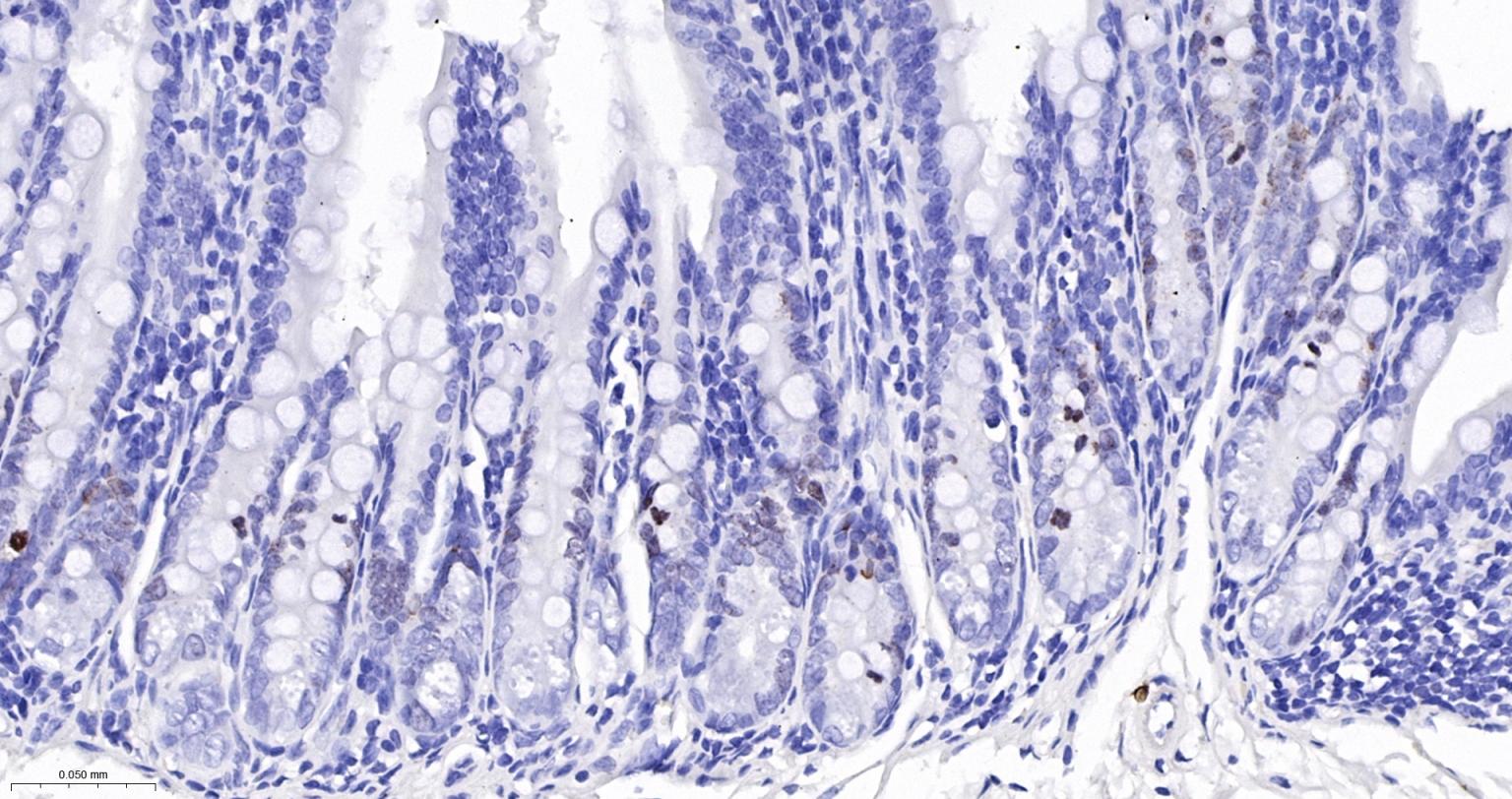 Ki67重组兔单抗-bsm-52455R