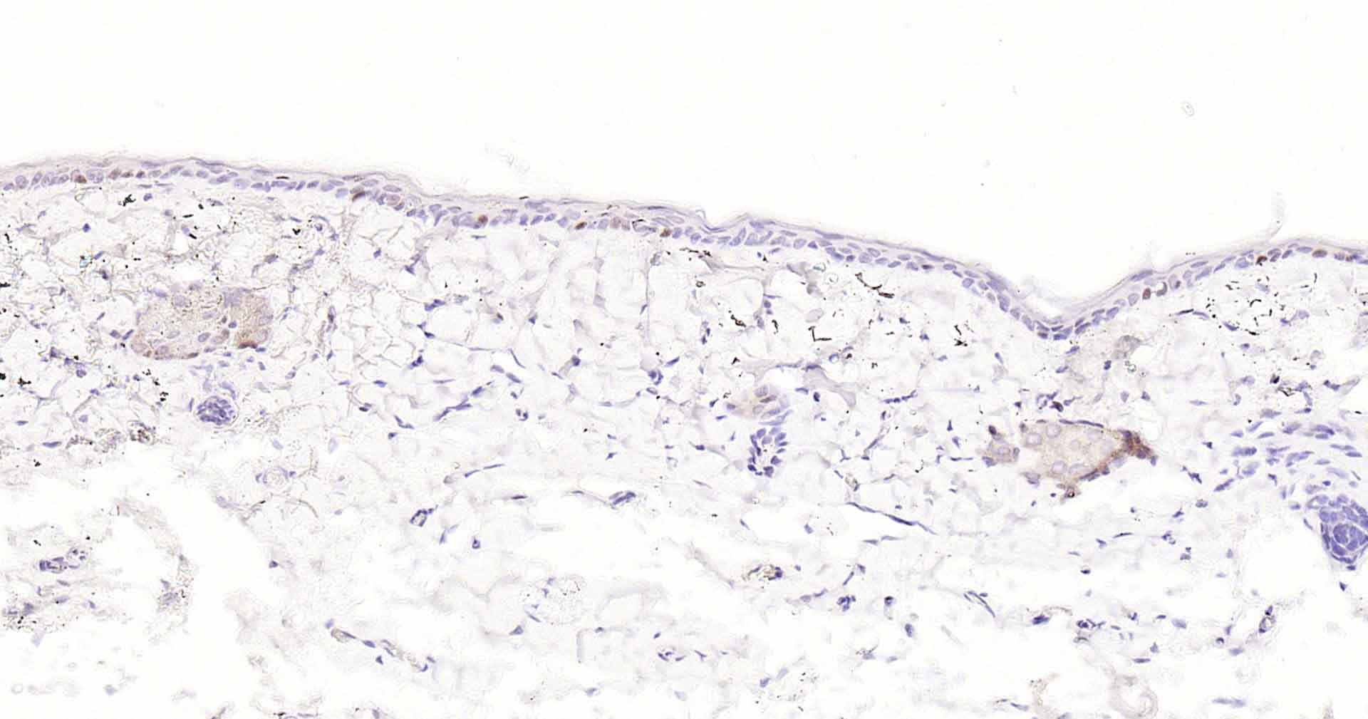 Ki67重组兔单抗-bsm-52455R