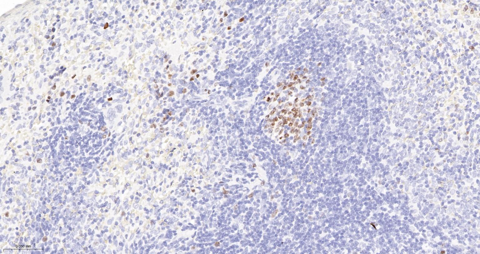 Ki67重组兔单抗-bsm-52455R