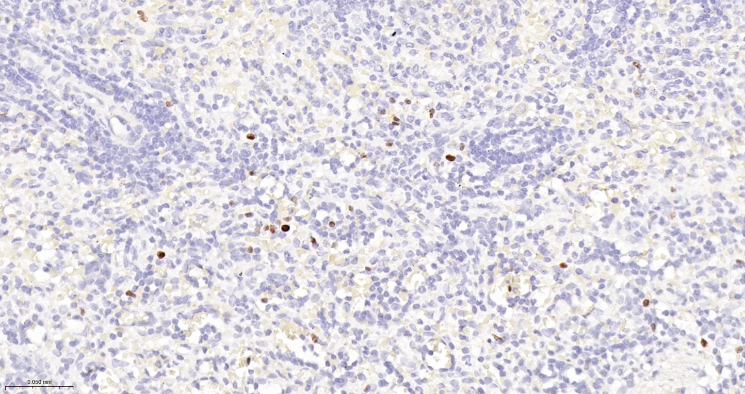 Ki67重组兔单抗-bsm-52455R