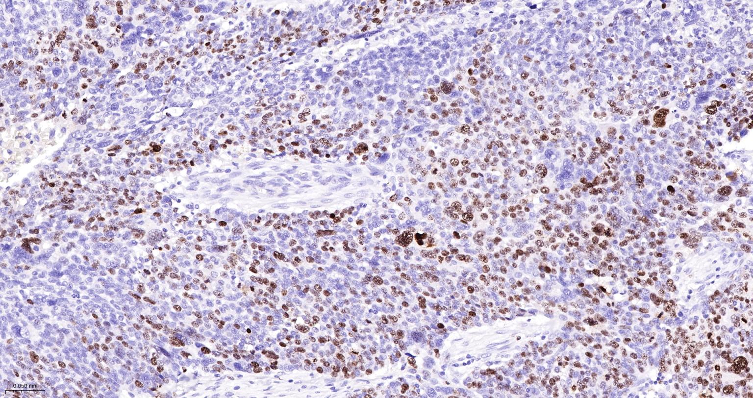 Ki67重组兔单抗-bsm-52455R