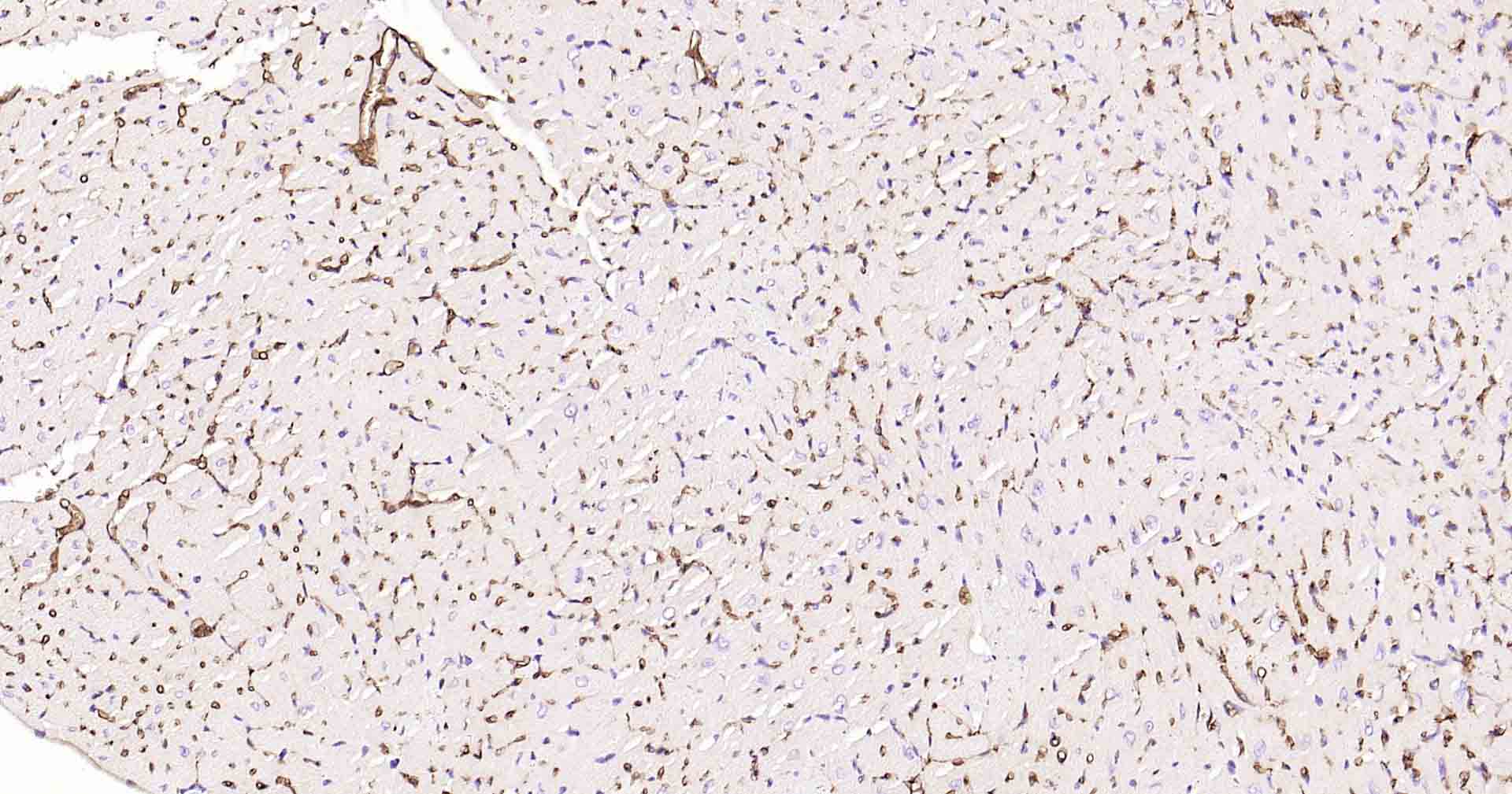 水通道蛋白1重组兔单抗-bsm-52909R