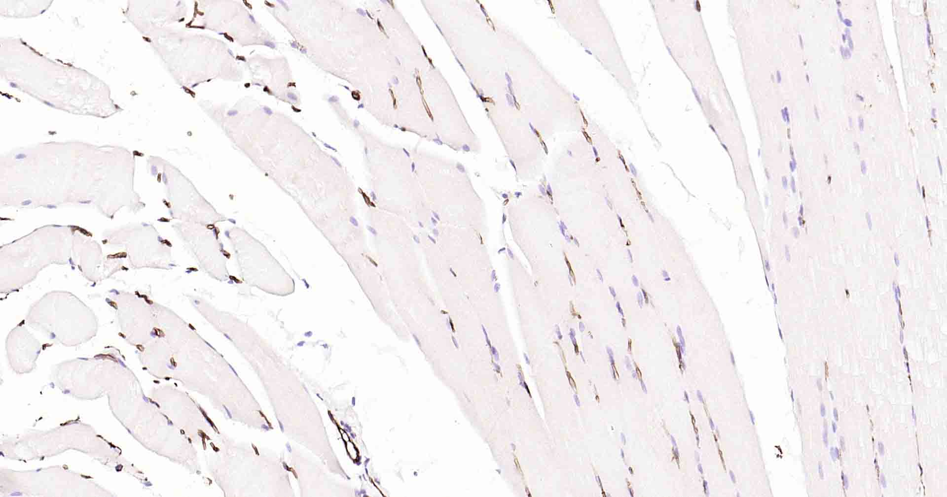 水通道蛋白1重组兔单抗-bsm-52909R