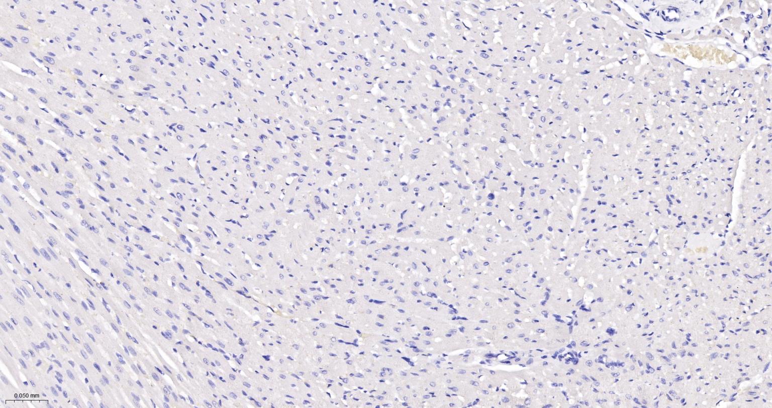 Ki67重组兔单抗-bsm-52455R