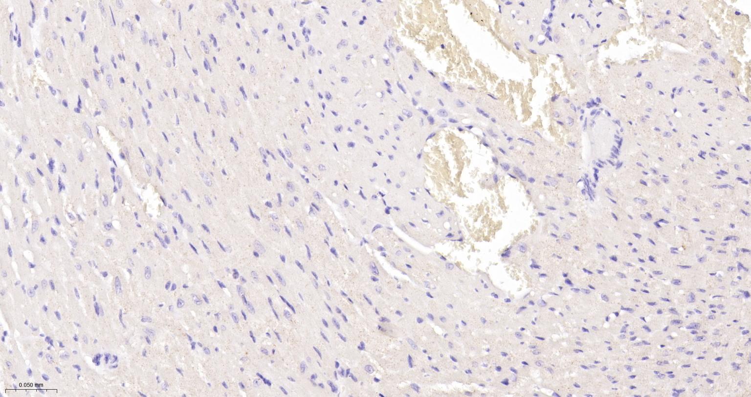 Ki67重组兔单抗-bsm-52455R