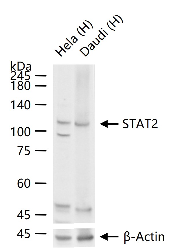 信号转导和转录激活因子2重组兔单抗-bsm-52234R