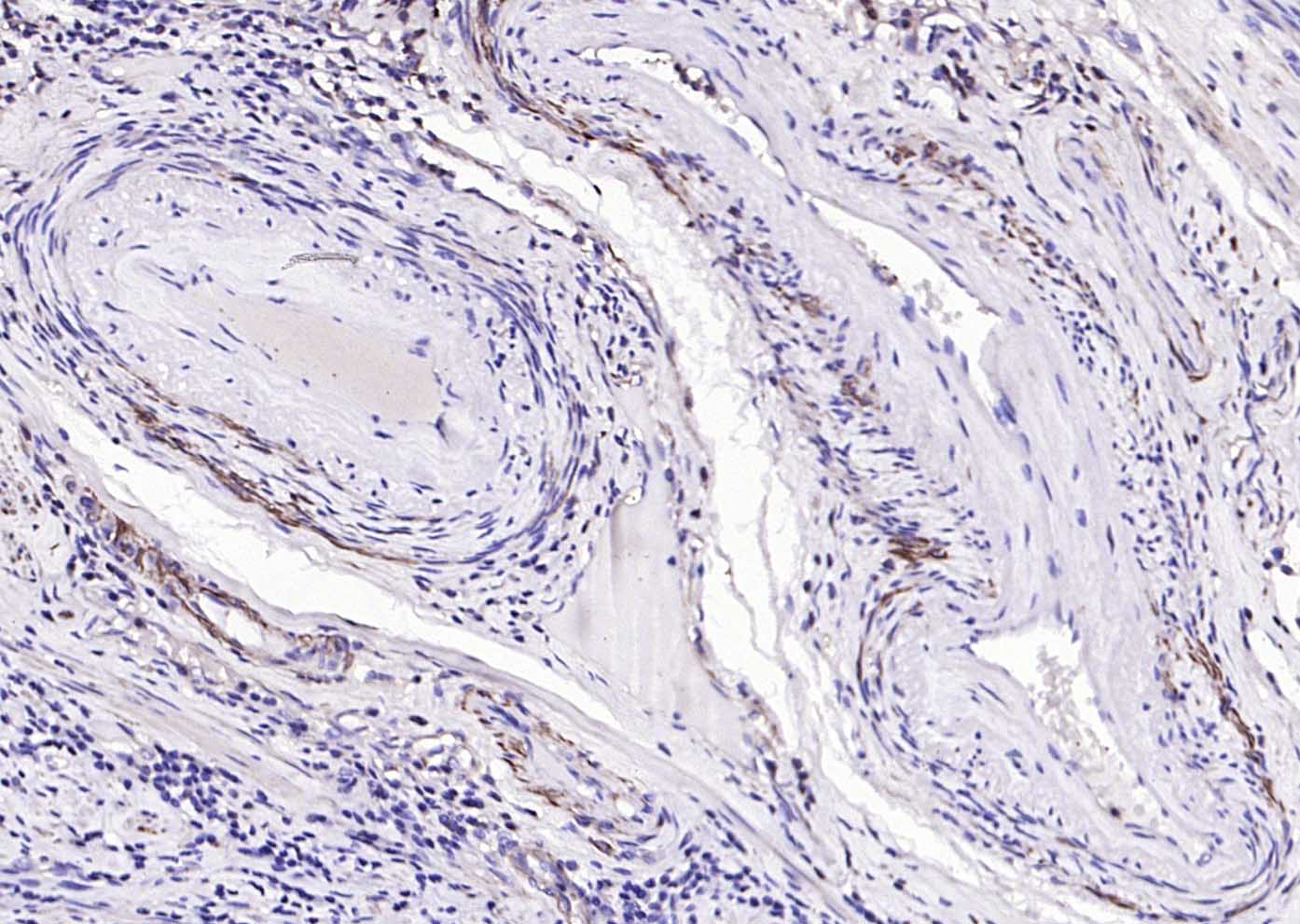 肌动蛋白α/α-SMA/α Actin抗体-bs-0189R