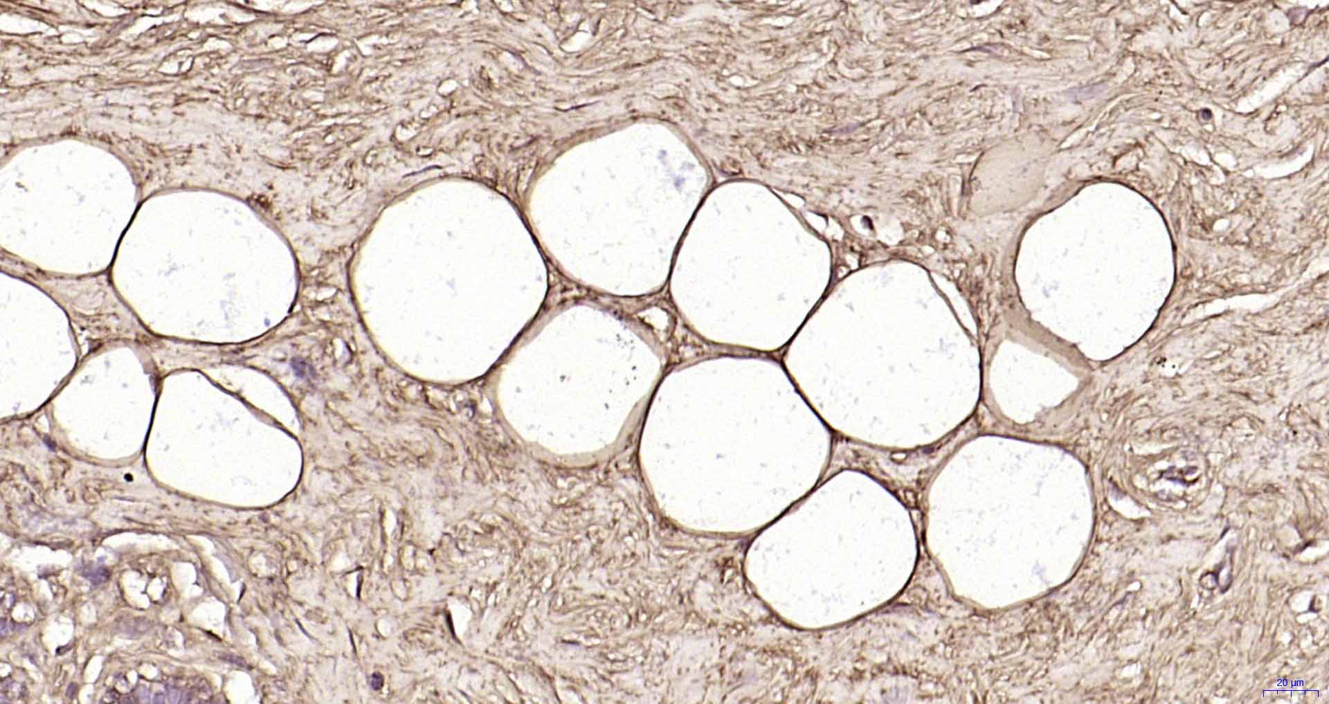 脂滴包被蛋白Perilipin-A重组兔单抗-bsm-61033R