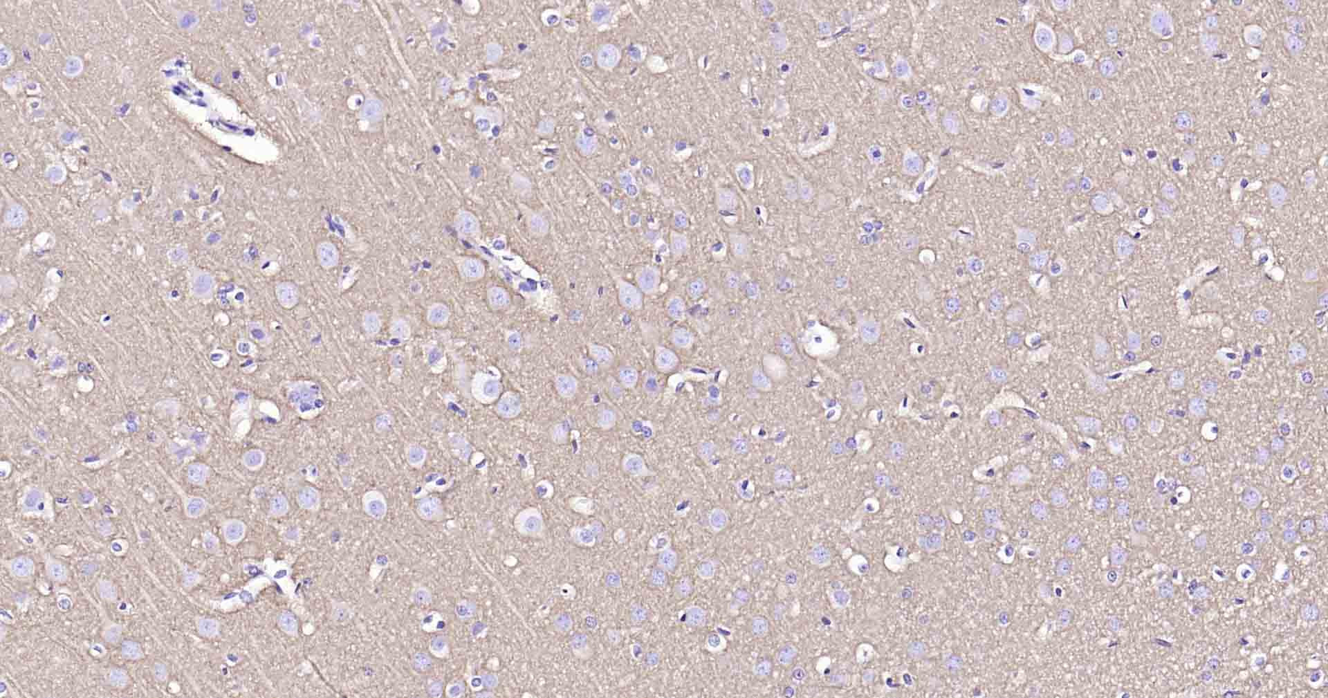 钠钾ATP酶蛋白a1重组兔单抗-bsm-52485R
