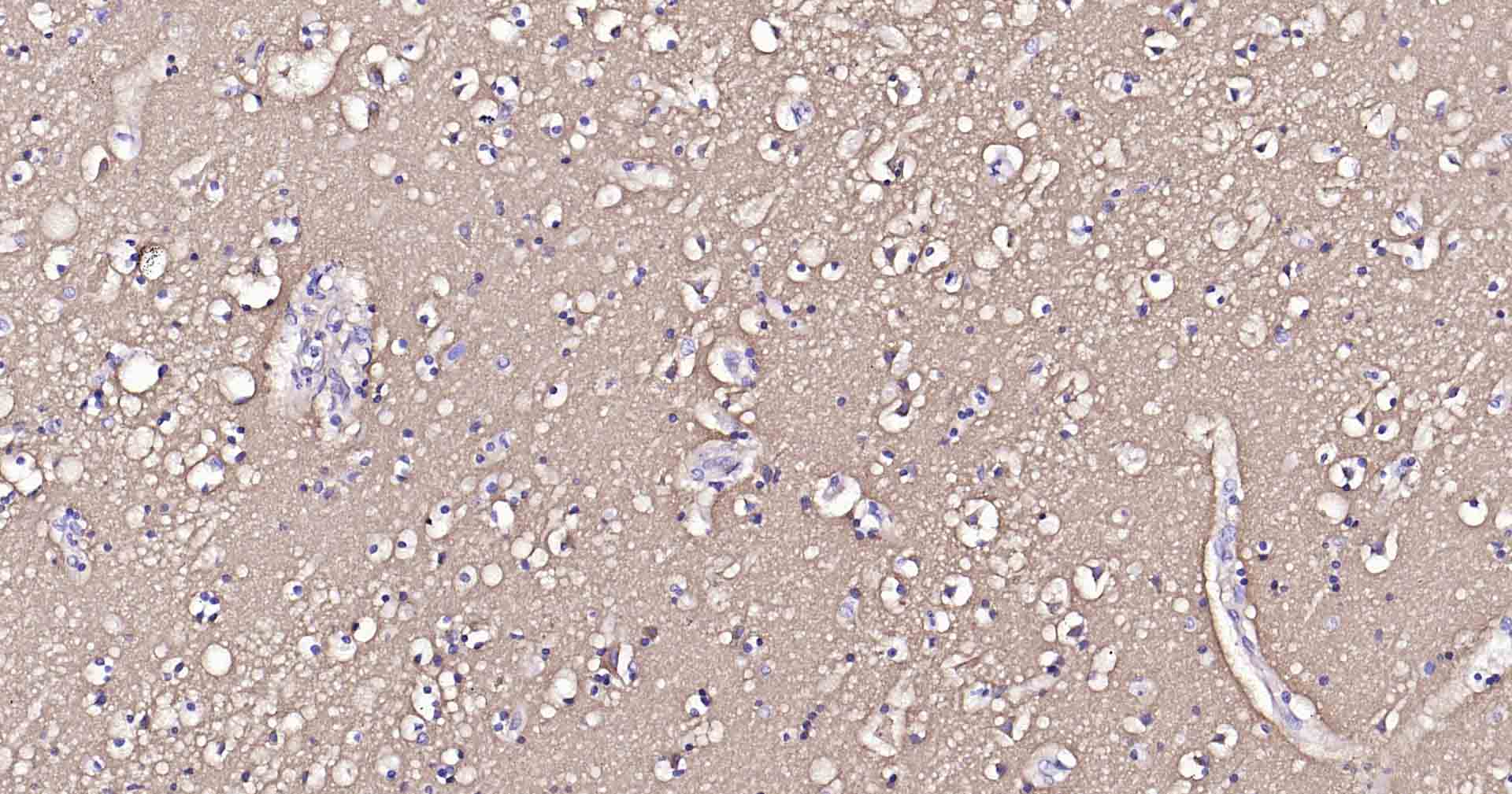 钠钾ATP酶蛋白a1重组兔单抗-bsm-52485R