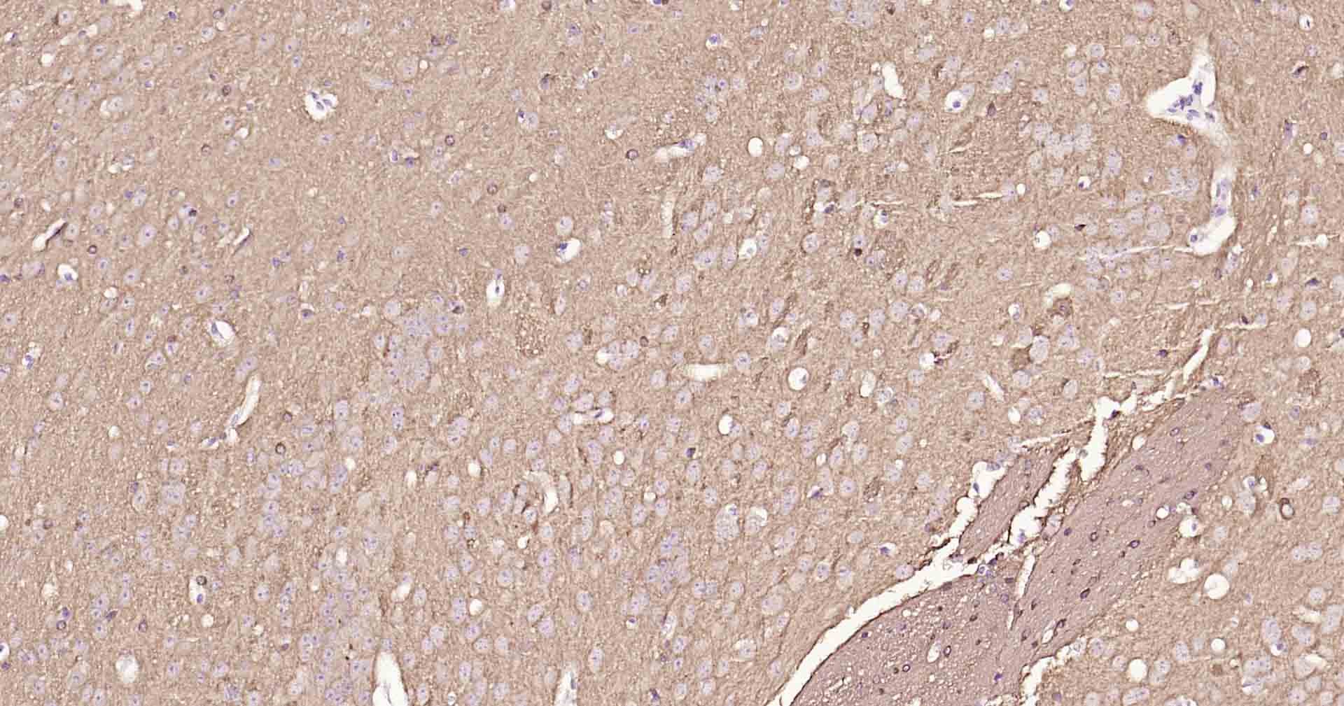 微管相关蛋白重组兔单抗-bsm-52310R