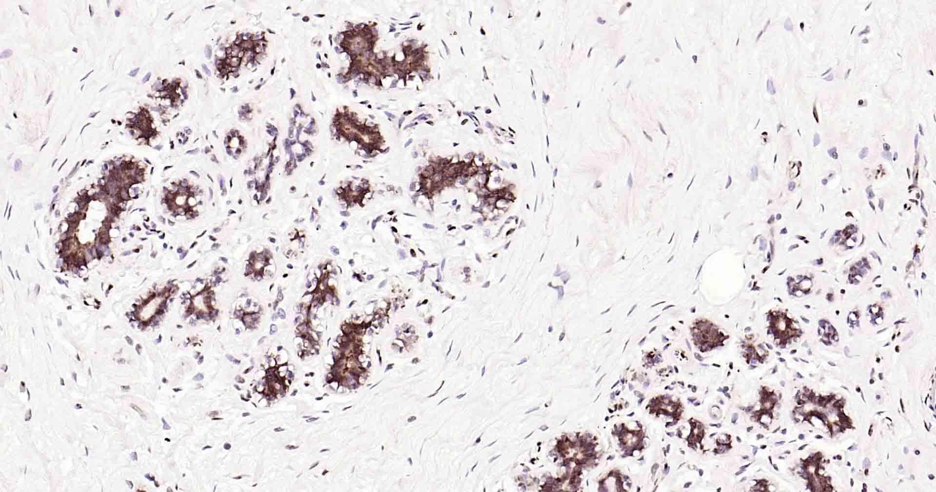 微管相关蛋白重组兔单抗-bsm-52310R
