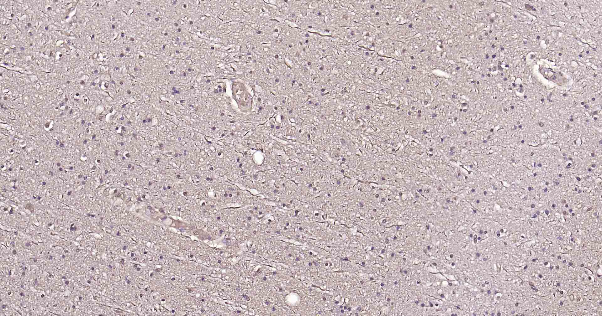 微管相关蛋白重组兔单抗-bsm-52310R