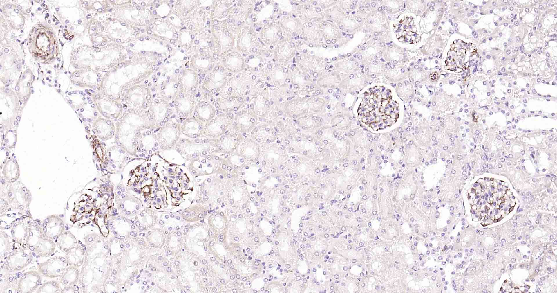 血管内皮生长因子重组兔单抗-bsm-56202R