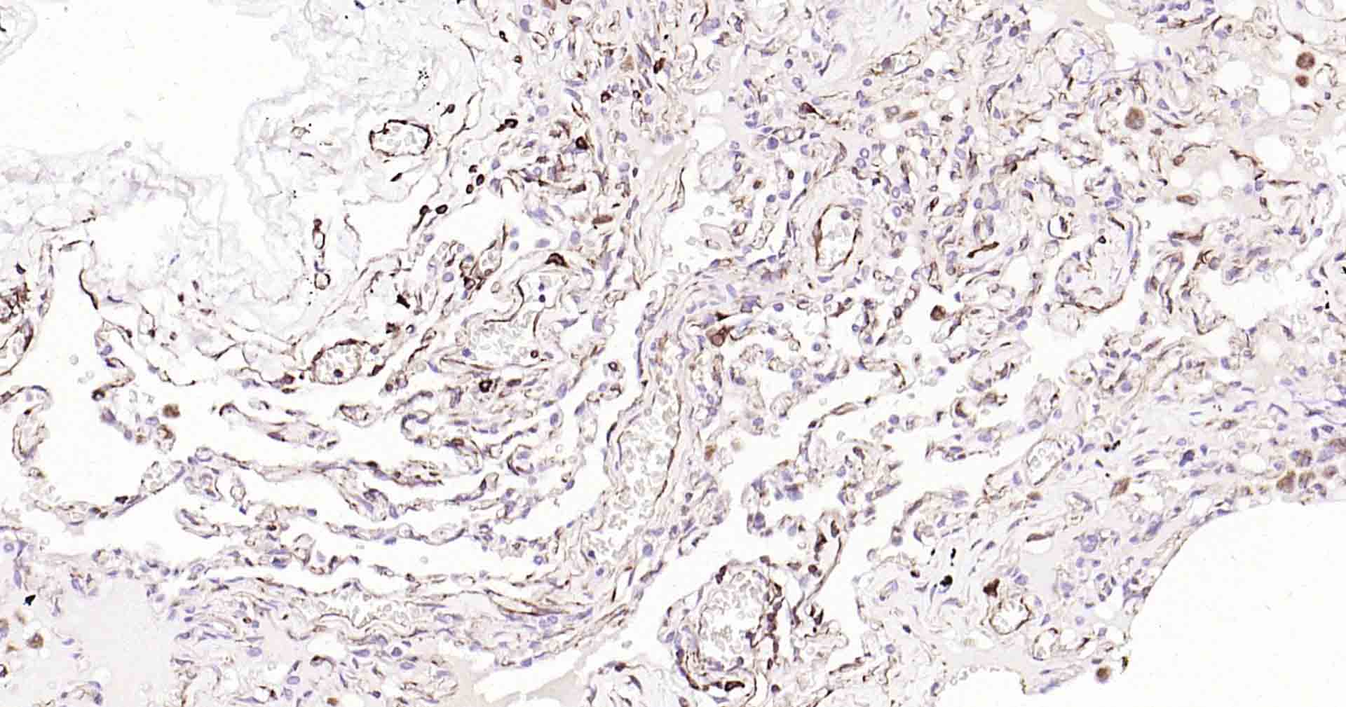 血管内皮生长因子重组兔单抗-bsm-56202R