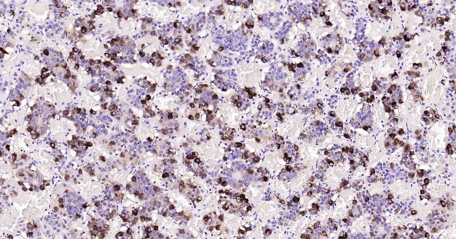 促卵泡刺激素重组兔单抗-bsm-61006R