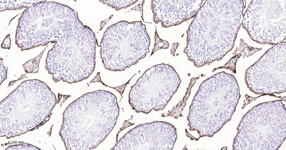 CD34重组兔单抗-bsm-60829R