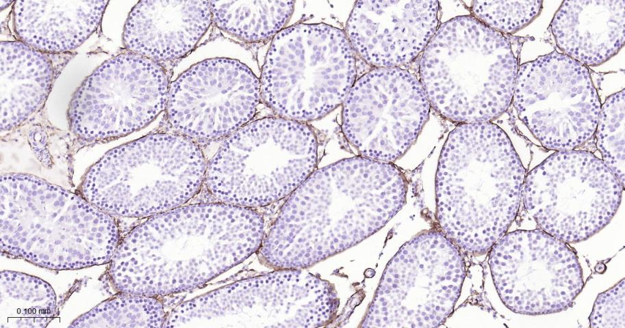 CD34重组兔单抗-bsm-60829R