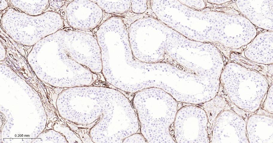 CD34重组兔单抗-bsm-60829R