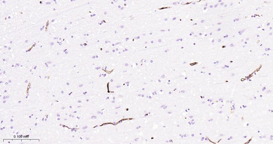 CD34重组兔单抗-bsm-60829R