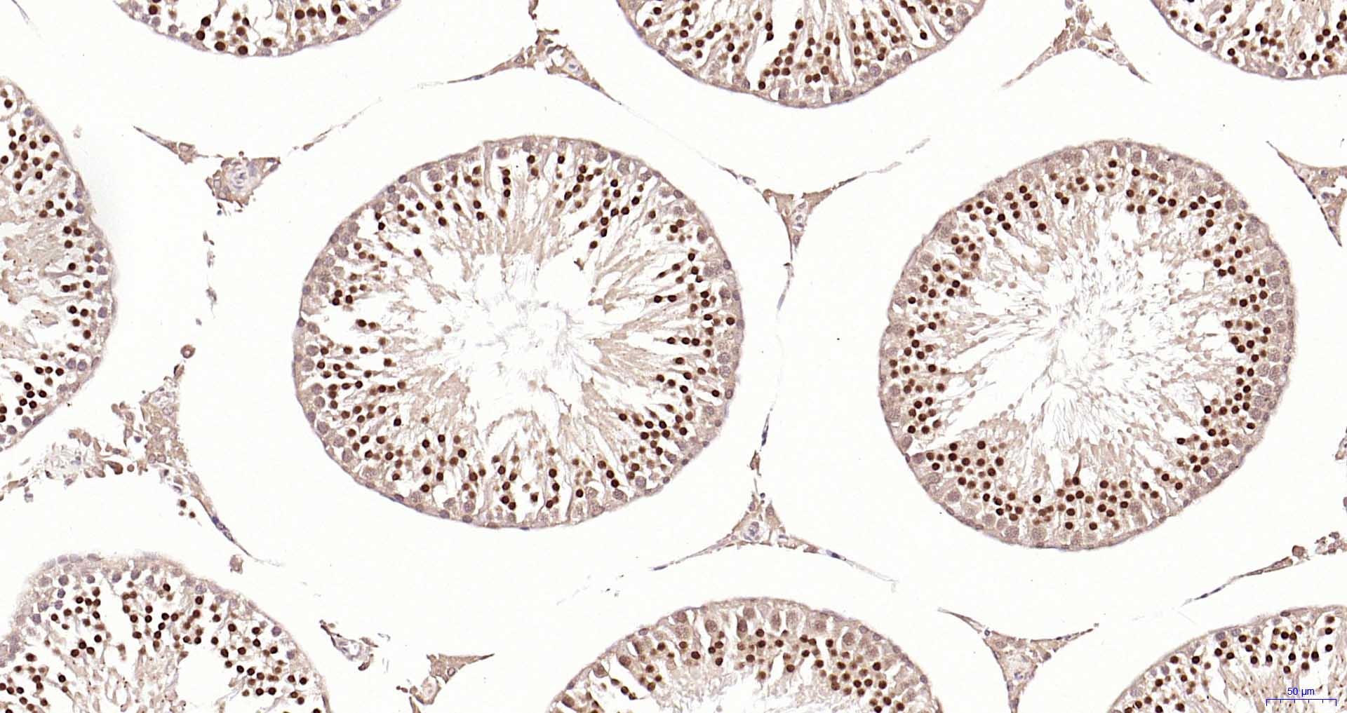 磷脂酰肌醇激酶p85β重组兔单抗-bsm-52217R