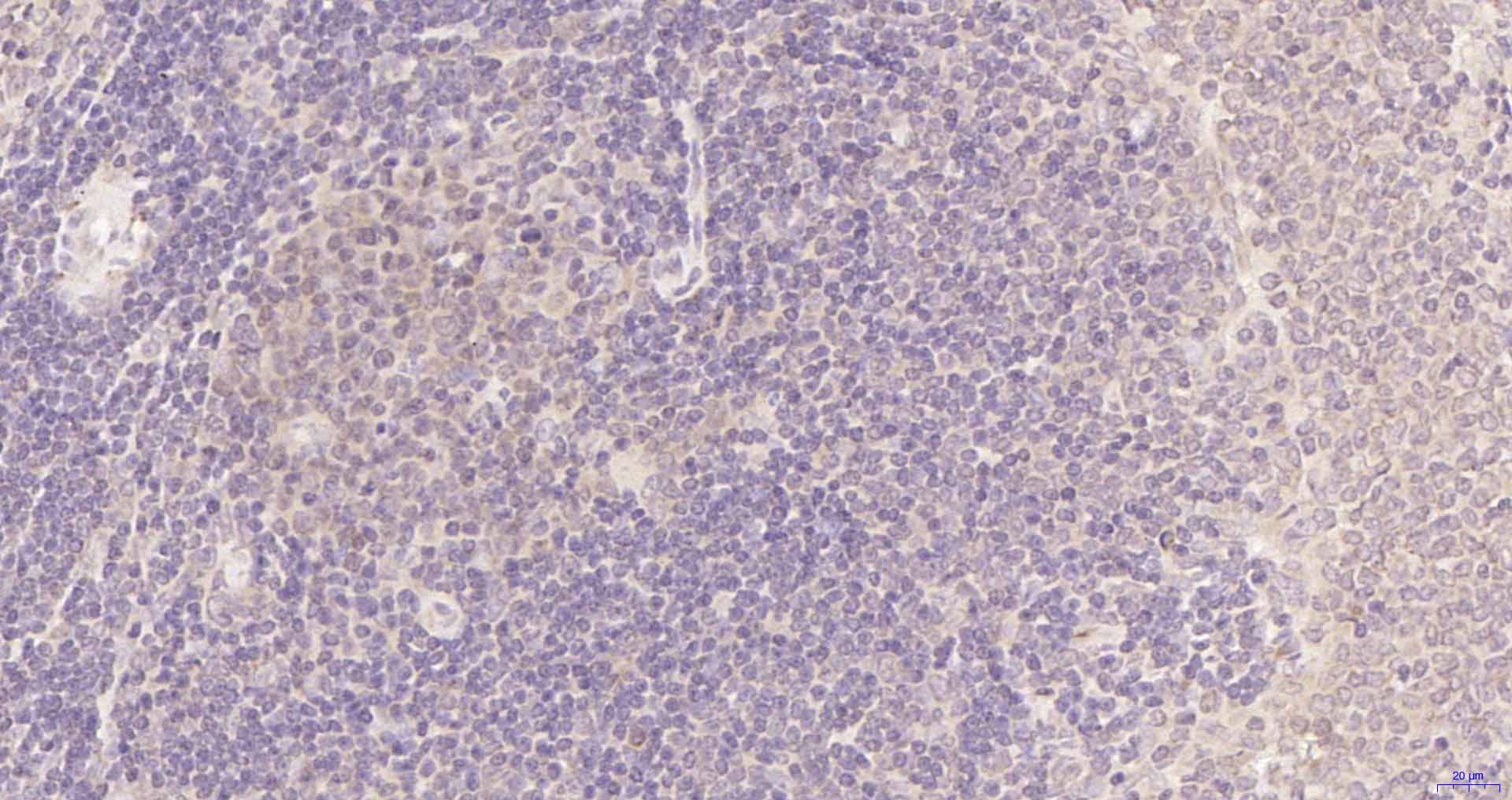 磷脂酰肌醇激酶p85β重组兔单抗-bsm-52217R