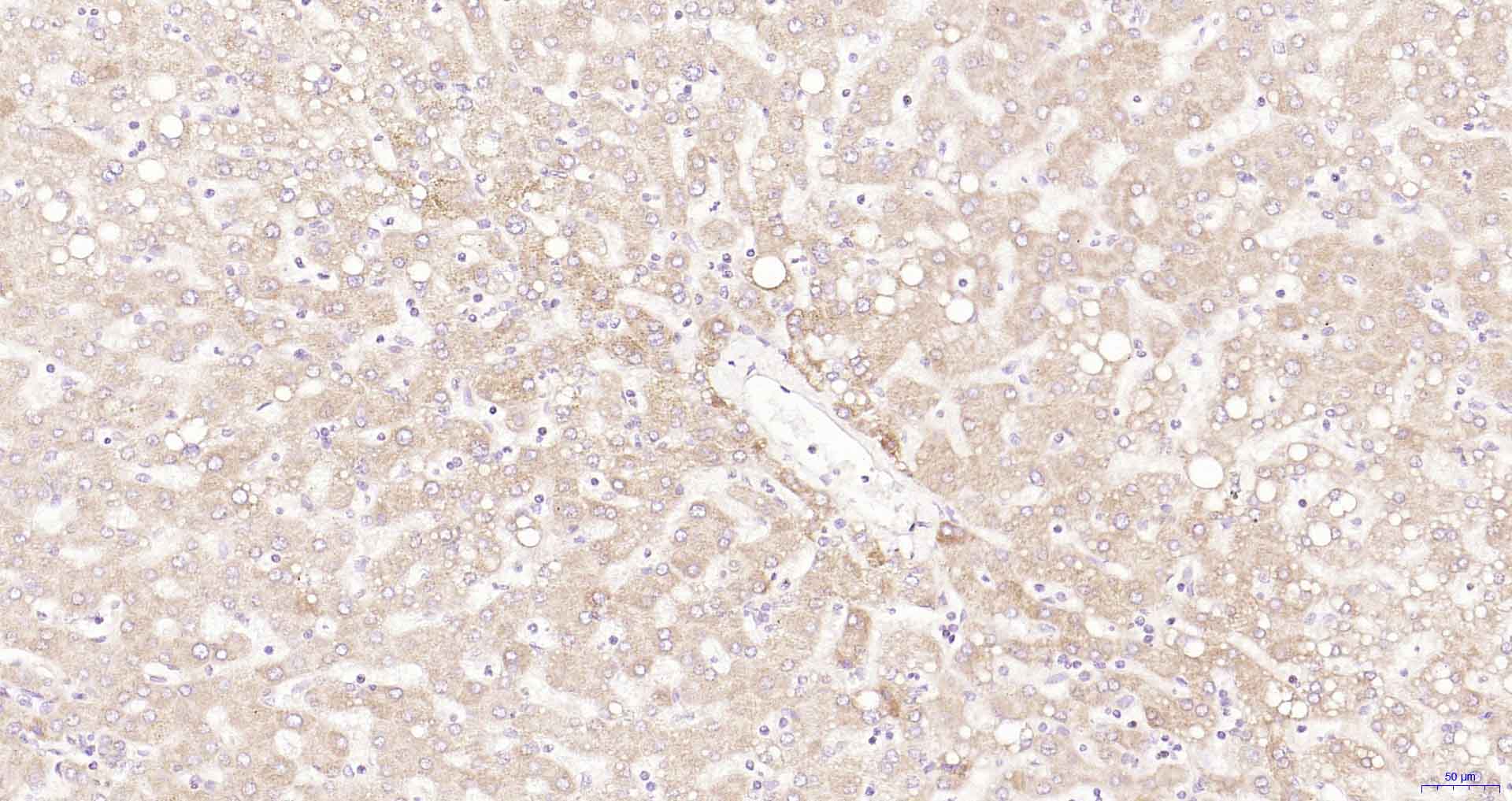 自噬相关蛋白1重组兔单抗-bsm-61039R