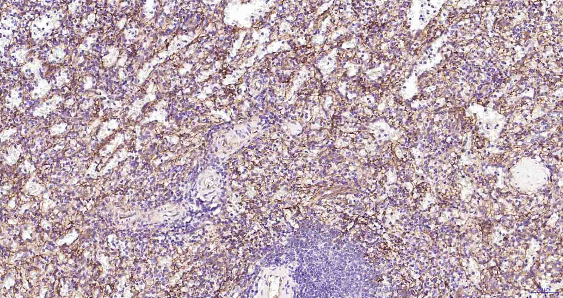 CD105重组兔单抗-bsm-61042R