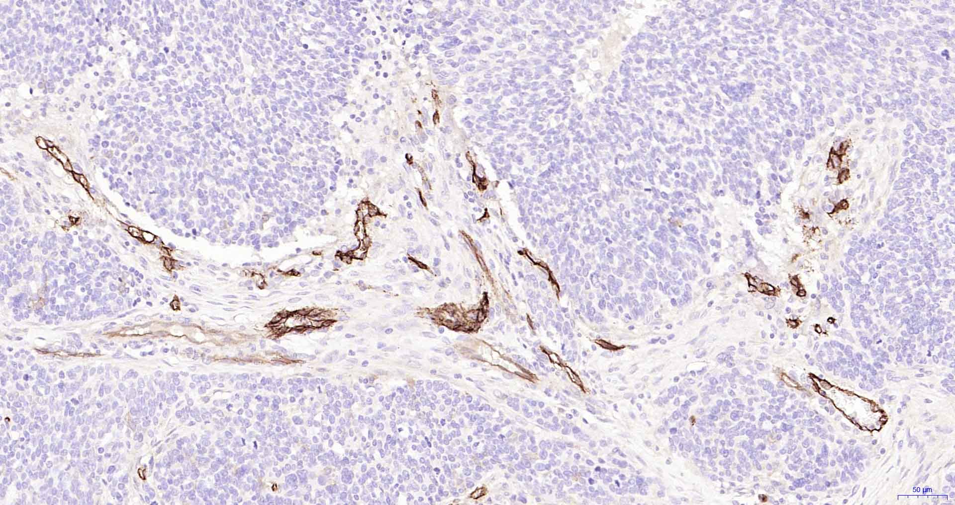CD105重组兔单抗-bsm-61042R