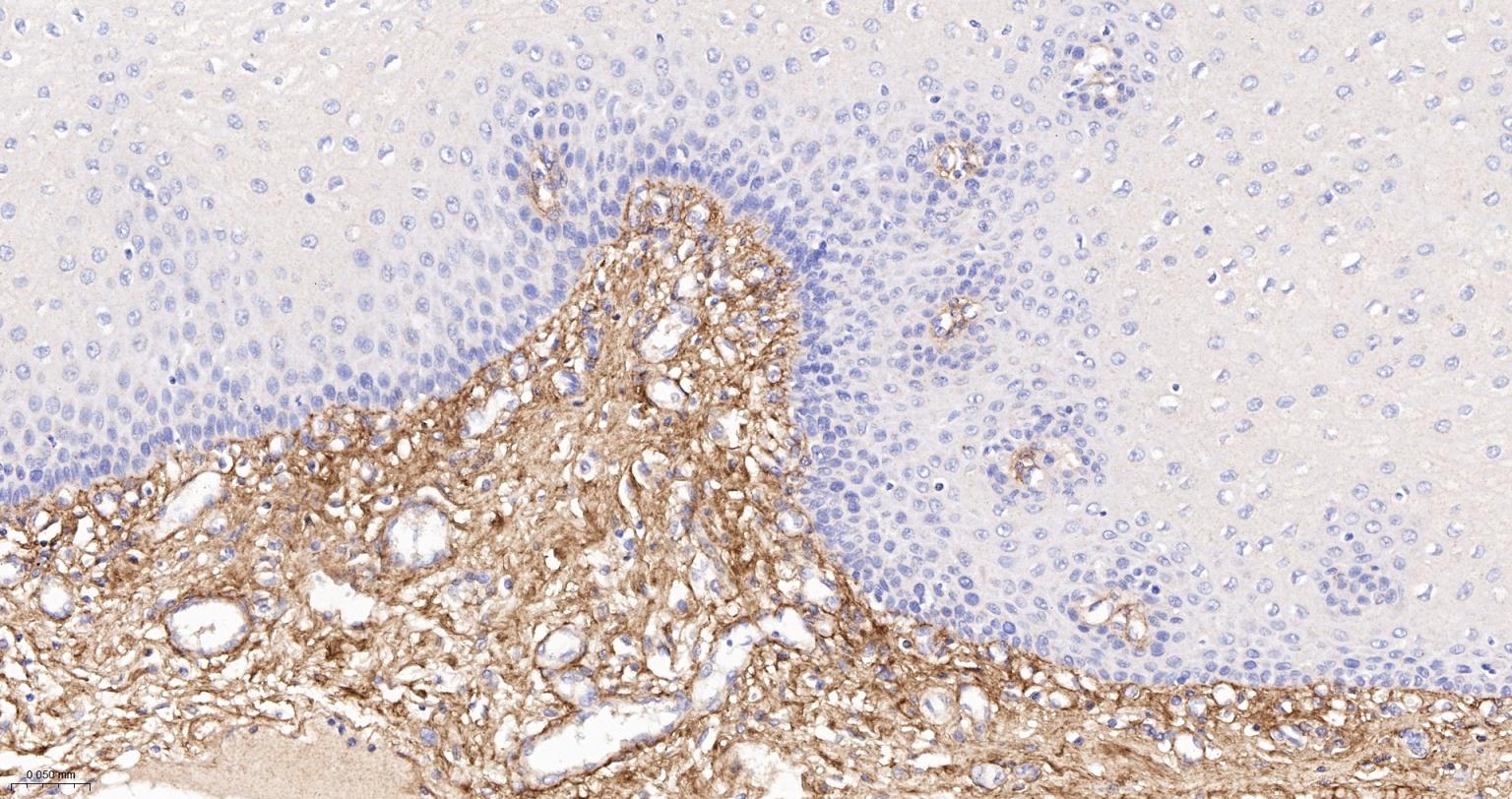 6型胶原重组兔单抗-bsm-61026R