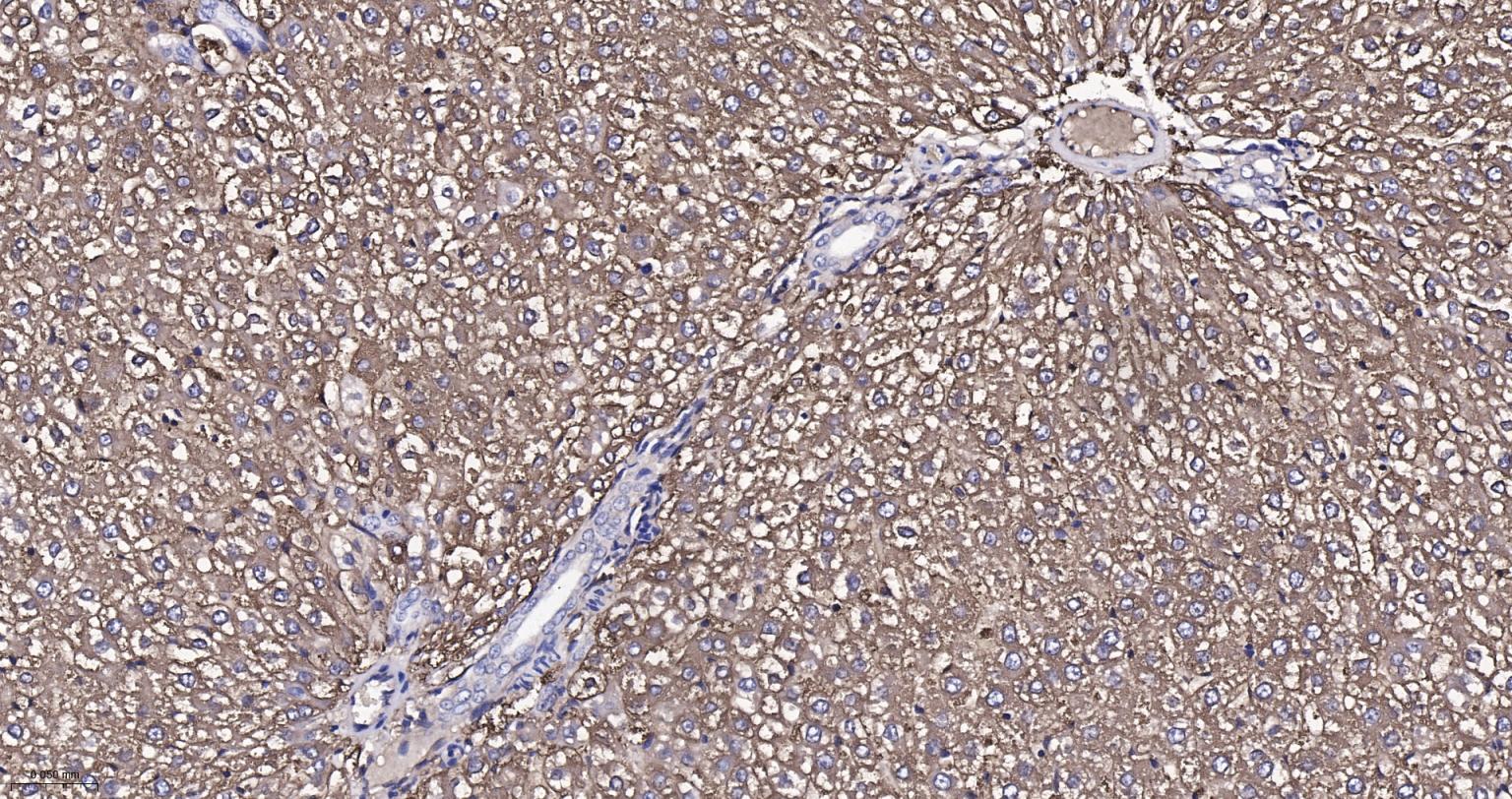 成纤维细胞生长因子21重组兔单抗-bsm-52978R