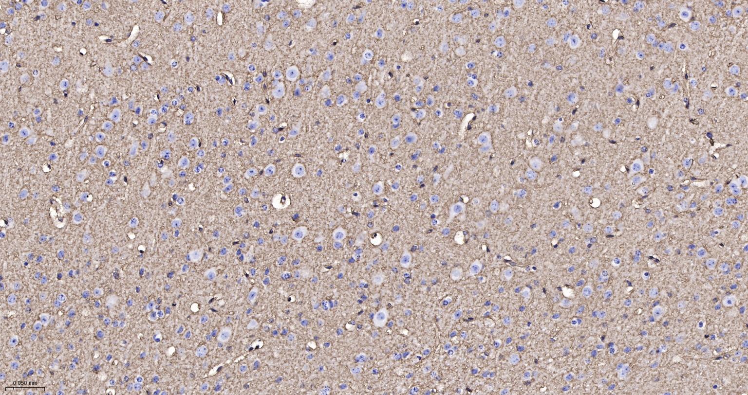 水通道蛋白4重组兔单抗-bsm-61035R