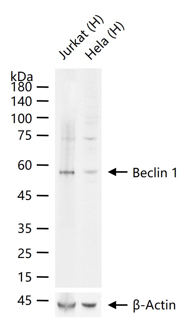 自噬效应蛋白Beclin 1重组兔单抗-bsm-41365R