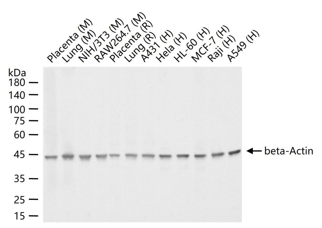 β-肌动蛋白/β-Actin（内参）单克隆抗体-bsm-33036M