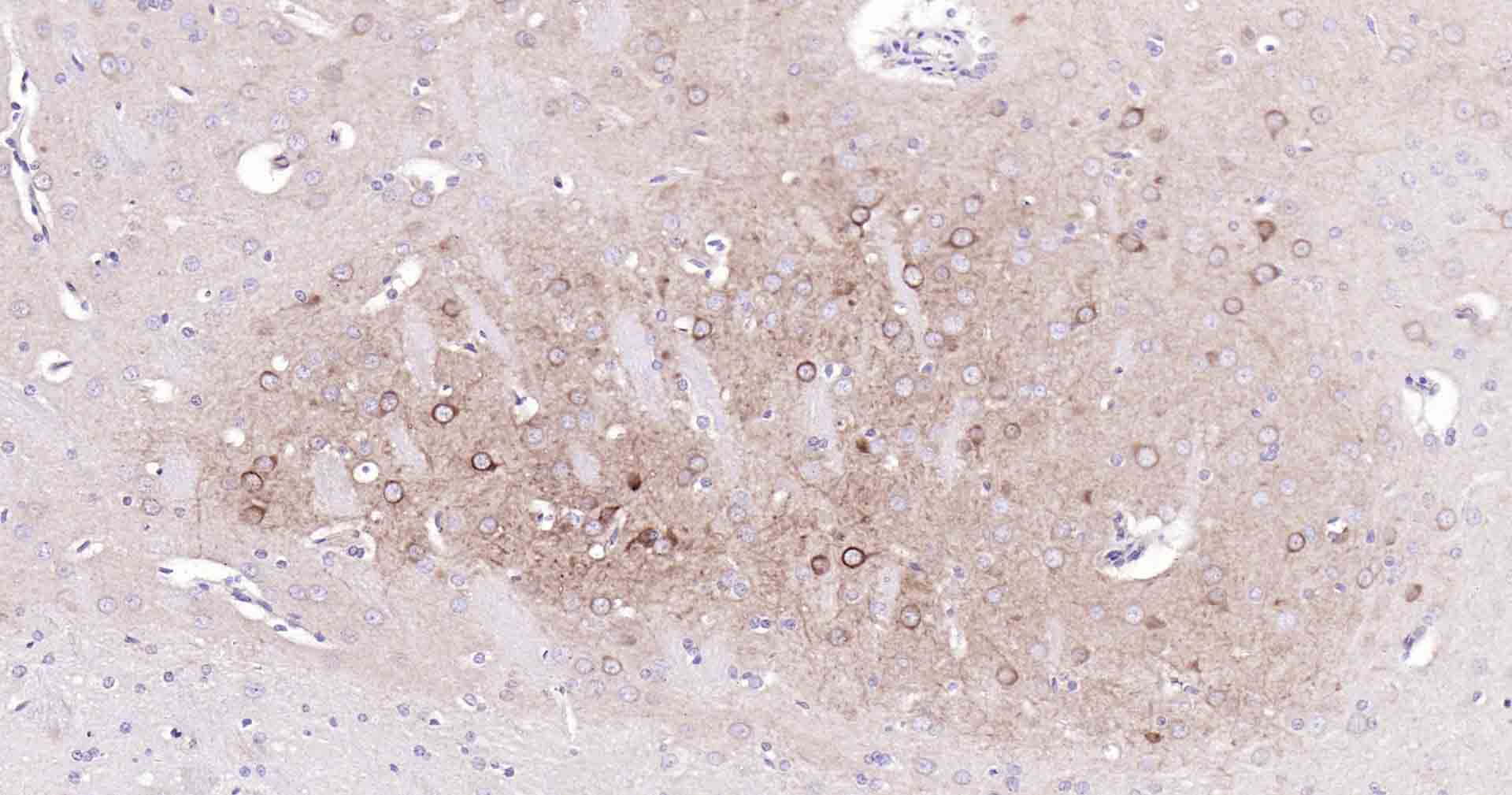 自噬效应蛋白Beclin 1重组兔单抗-bsm-41365R