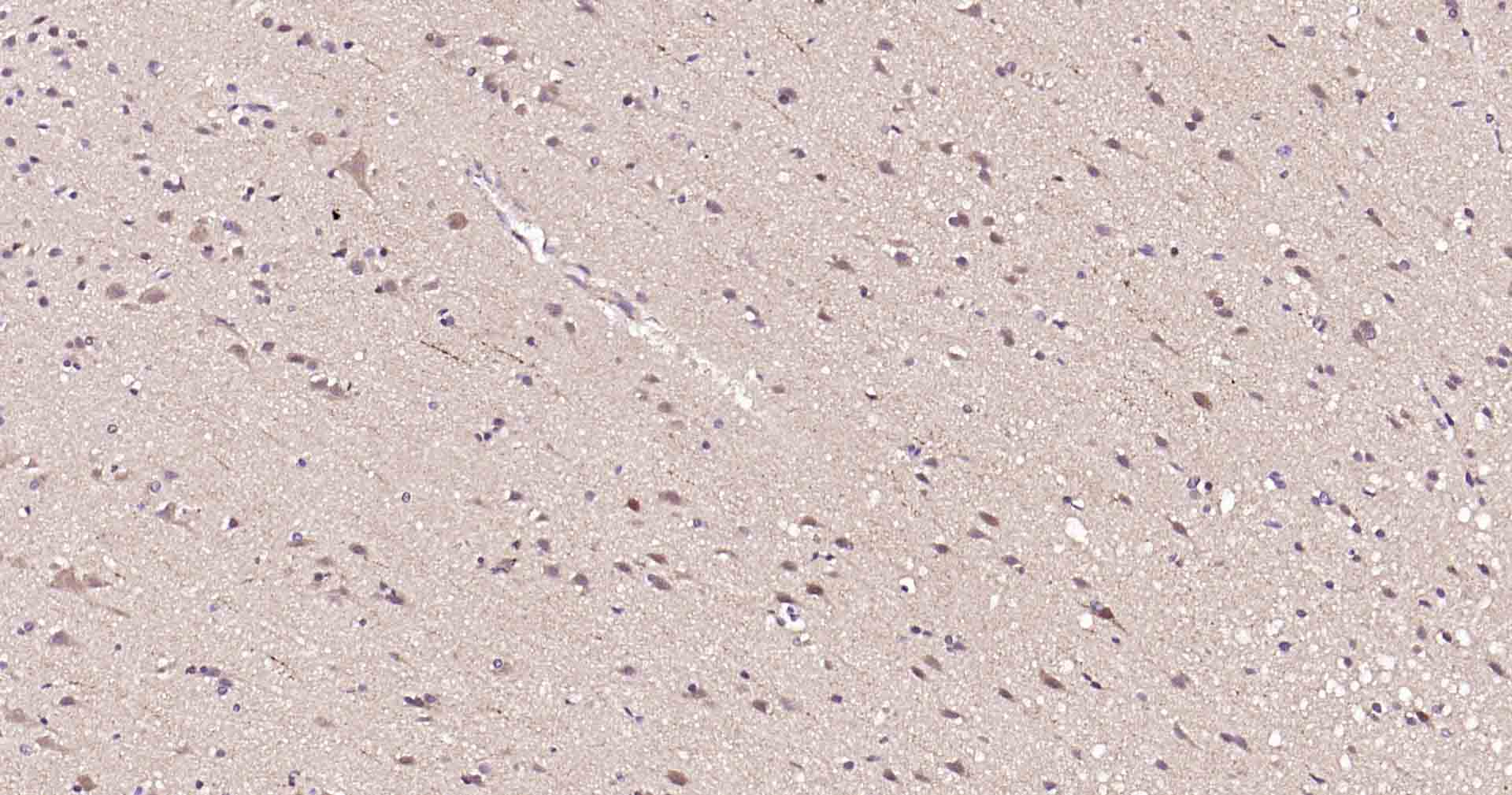 自噬效应蛋白Beclin 1重组兔单抗-bsm-41365R