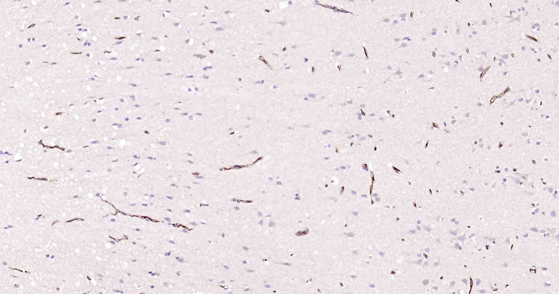 P-糖蛋白重组兔单克隆抗体-bsm-54782R