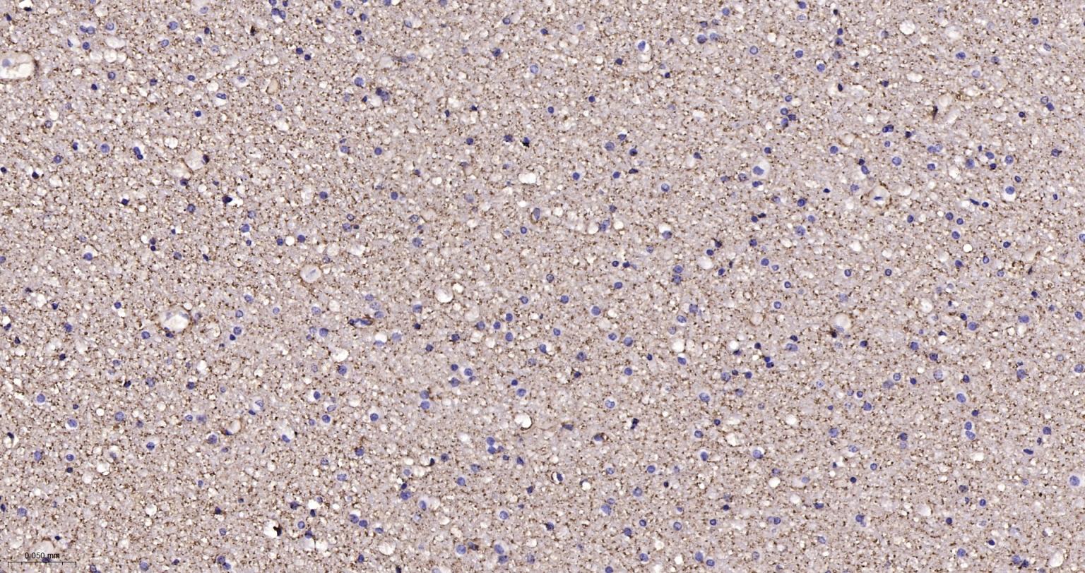 水通道蛋白4重组兔单抗-bsm-61035R