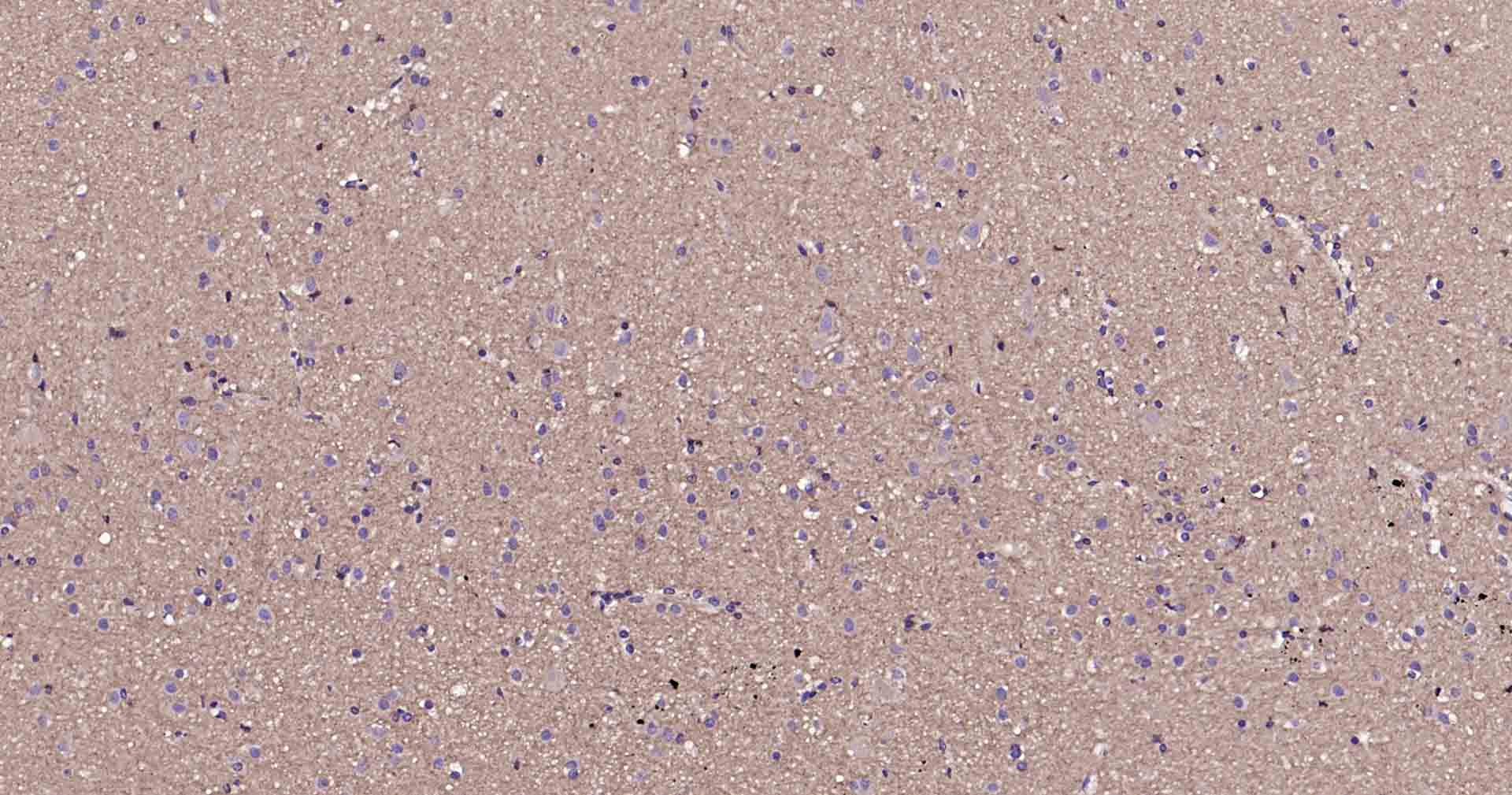 Ras样蛋白A重组兔单抗-bsm-61044R