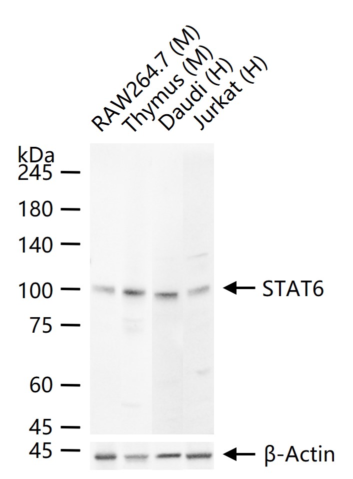 信号转导和转录激活因子6重组兔单抗-bsm-52239R