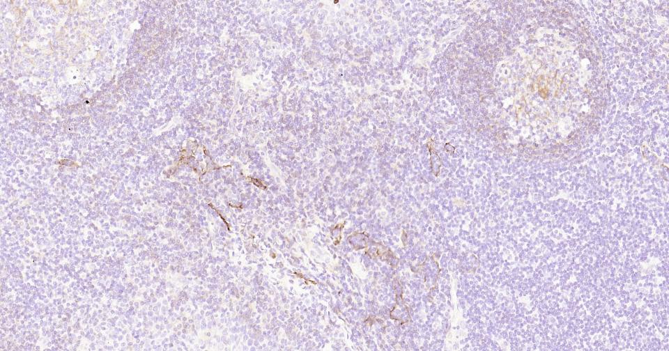 CD73重组兔单抗-bsm-52916R
