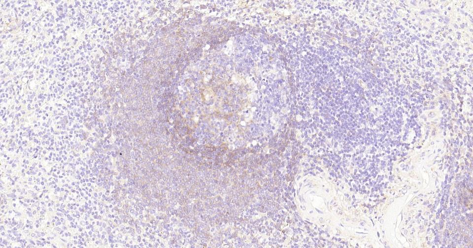 CD73重组兔单抗-bsm-52916R